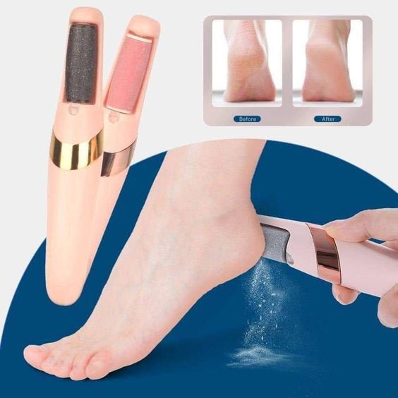 Appareil Anti-Callosités – Pieds Doux